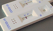 Kostenlose Coronatests für Bürgerinnen und Bürger